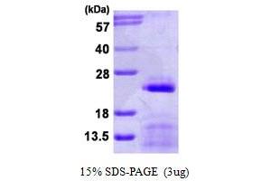 Image no. 1 for Small Nuclear Ribonucleoprotein Polypeptide C (SNRPC) (AA 1-159) protein (His tag) (ABIN6386854)