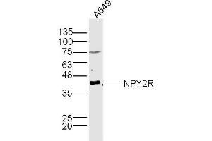Image no. 2 for anti-Neuropeptide Y Receptor Y2 (NPY2R) (AA 301-381) antibody (ABIN730063)
