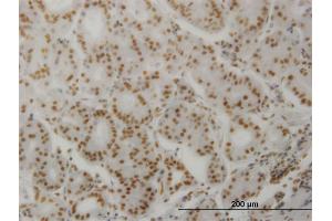 Image no. 1 for anti-Protein Phosphatase 3, Catalytic Subunit, alpha Isoform (PPP3CA) (AA 1-84) antibody (ABIN519132)
