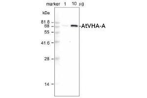 Image no. 1 for anti-ATPase, H+ Transporting, Lysosomal 38kDa, V0 Subunit D2 (ATP6V0D2) antibody (ABIN349654)