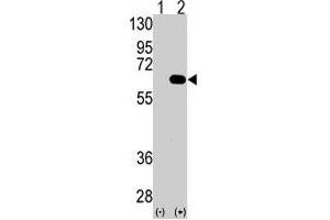 Image no. 1 for anti-Autocrine Motility Factor Receptor (AMFR) (Isoform 2) antibody (ABIN542704)