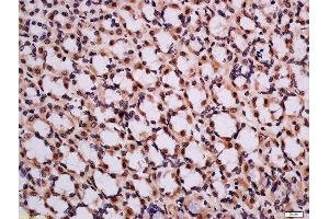 Image no. 1 for anti-Charged Multivesicular Body Protein 2A (CHMP2A) (AA 1-100) antibody (ABIN2559687)
