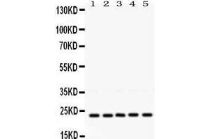 Image no. 1 for anti-RAB18, Member RAS Oncogene Family (RAB18) (AA 156-192), (C-Term) antibody (ABIN3043365)