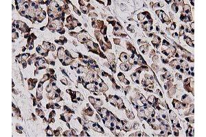 Image no. 3 for anti-Histone Deacetylase 6 (HDAC6) antibody (ABIN2722516)