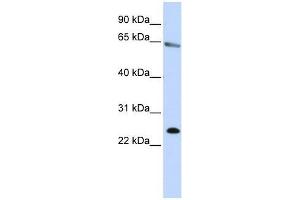 Image no. 1 for anti-Zinc Finger Protein 326 (ZNF326) (N-Term) antibody (ABIN927920)