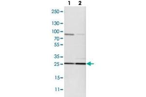 Image no. 4 for anti-Mercaptopyruvate Sulfurtransferase (MPST) antibody (ABIN5583703)