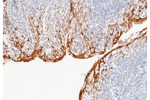 Image no. 1 for anti-S100 Calcium Binding Protein A8 (S100A8) (AA 2-93) antibody (ABIN2214818)