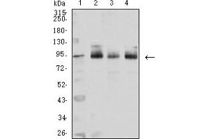 Image no. 5 for anti-Catenin (Cadherin-Associated Protein), beta 1, 88kDa (CTNNB1) (AA 1-100) antibody (ABIN5611272)