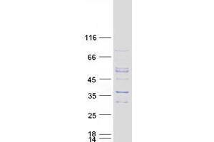 Image no. 1 for Williams Beuren Syndrome Chromosome Region 27 (WBSCR27) protein (Myc-DYKDDDDK Tag) (ABIN2735490)