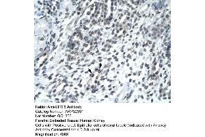 Image no. 3 for anti-Sirtuin 5 (SIRT5) (Middle Region) antibody (ABIN2779613)