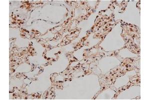 Image no. 2 for anti-Insulin-Like Growth Factor 1 Receptor (IGF1R) (pTyr1346) antibody (ABIN6256637)