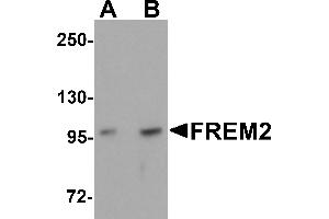 Western Blotting (WB) image for anti-Fras1 Related Extracellular Matrix Protein 2 (FREM2) (Middle Region) antibody (ABIN1030933)
