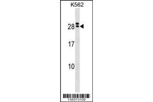 Image no. 1 for anti-Interleukin 15 Receptor, alpha (IL15RA) (AA 79-106) antibody (ABIN1538627)