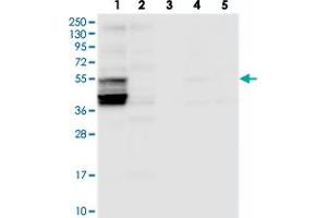 Image no. 2 for anti-Solute Carrier Family 38, Member 7 (SLC38A7) antibody (ABIN5588200)