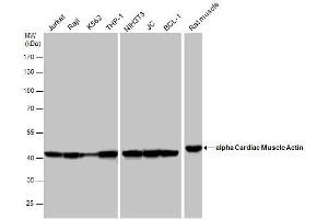 Image no. 4 for anti-Actin, Alpha, Cardiac Muscle 1 (ACTC1) (Center) antibody (ABIN2855212)