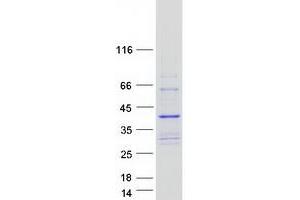 Image no. 1 for Collectin Sub-Family Member 11 (COLEC11) (Transcript Variant 2) protein (Myc-DYKDDDDK Tag) (ABIN2712436)