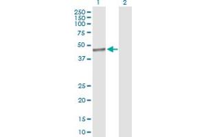 anti-tRNA Splicing Endonuclease 34 Homolog (TSEN34) (AA 1-390) antibody