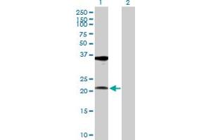 Image no. 1 for anti-Ribosomal Protein L10a (RPL10A) (AA 1-217) antibody (ABIN518273)