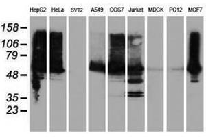 Image no. 14 for anti-IlvB (Bacterial Acetolactate Synthase)-Like (ILVBL) antibody (ABIN1498878)