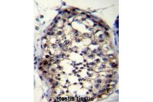 Image no. 1 for anti-Rhophilin Associated Tail Protein 1-Like (ROPN1L) (AA 39-68), (N-Term) antibody (ABIN954578)