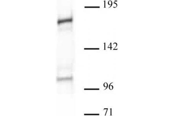 BAZ1A antibody  (C-Term)
