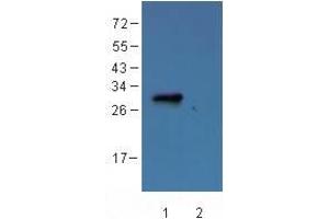Image no. 2 for anti-Dendra 2 antibody (ABIN361314)