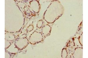 Immunohistochemistry of paraffin-embedded human thyroid tissue using ABIN7164418 at dilution of 1:100