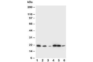 Image no. 2 for anti-Signal Sequence Receptor gamma (SSRg) (AA 8-23) antibody (ABIN3032563)