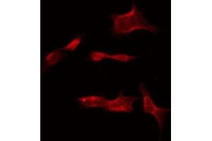 Image no. 1 for anti-Neuron-Specific Protein Family Member 1 (D4S234E) (Internal Region) antibody (ABIN6259604)