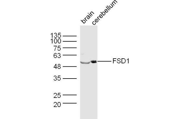 FSD1 antibody  (AA 421-496)