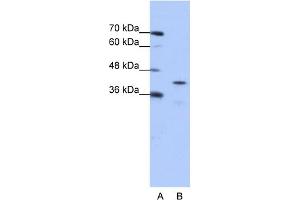 Image no. 1 for anti-Cytoplasmic Polyadenylation Element Binding Protein 2 (CPEB2) (Middle Region) antibody (ABIN2776669)
