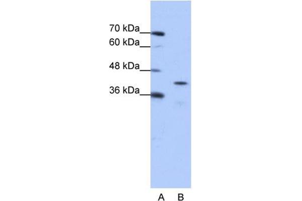 anti-Cytoplasmic Polyadenylation Element Binding Protein 2 (CPEB2) (Middle Region) antibody