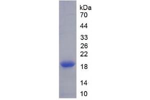 Image no. 4 for Dipeptidyl-Peptidase 4 (DPP4) ELISA Kit (ABIN6574232)