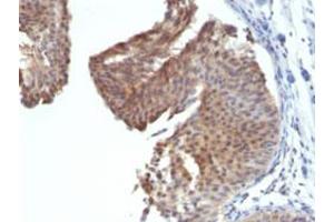Image no. 1 for anti-Keratin 6A (KRT6A) antibody (ABIN5582200)