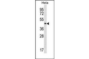 Image no. 1 for anti-DnaJ (Hsp40) Homolog, Subfamily A, Member 3 (DNAJA3) (AA 104-134), (N-Term) antibody (ABIN951939)