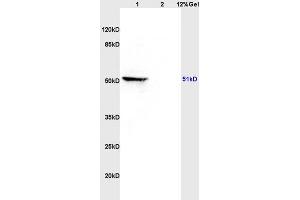 Image no. 1 for anti-Mitogen-Activated Protein Kinase Kinase Kinase 8 (MAP3K8) (AA 121-220) antibody (ABIN701275)