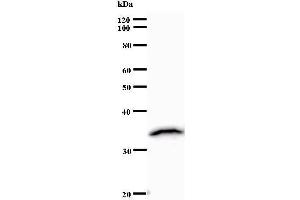 Image no. 1 for anti-ZINC FINGER PROTEIN 136 (ZNF136) antibody (ABIN932448)