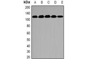 Image no. 2 for anti-O-Linked N-Acetylglucosamine (GlcNAc) Transferase (UDP-N-Acetylglucosamine:polypeptide-N-Acetylglucosaminyl Transferase) (OGT) (full length) antibody (ABIN6004956)