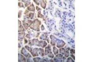 Image no. 3 for anti-Inhibitor of DNA Binding 1, Dominant Negative Helix-Loop-Helix Protein (ID1) (AA 73-101), (Middle Region) antibody (ABIN952815)