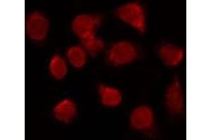 Image no. 1 for anti-Transcription Termination Factor, RNA Polymerase II (TTF2) antibody (ABIN6265782)