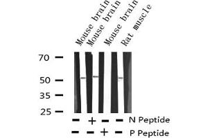 Image no. 3 for anti-Activating Transcription Factor 2 (ATF2) (pSer44), (pSer62) antibody (ABIN6255342)