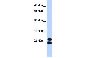 Image no. 1 for anti-Paired Related Homeobox 2 (PRRX2) (N-Term) antibody (ABIN2781006)
