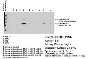Image no. 1 for anti-Cathepsin D (CTSD) (C-Term) antibody (ABIN2776841)