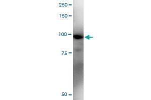 Image no. 1 for anti-RIO Kinase 1 (RIOK1) (AA 1-568) antibody (ABIN529488)
