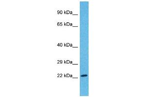 Image no. 1 for anti-Forkhead Box R1 (FOXR1) (N-Term) antibody (ABIN2777476)