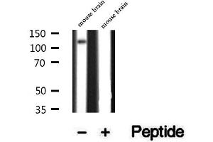 Image no. 2 for anti-ATPase, Class I, Type 8A, Member 1 (ATP8A1) antibody (ABIN6260139)
