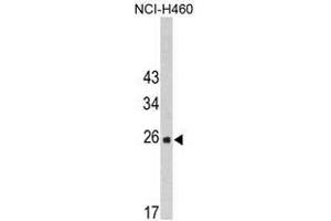 Image no. 1 for anti-FK506 Binding Protein 14, 22 KDa (FKBP14) (N-Term) antibody (ABIN453010)