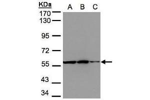Image no. 2 for anti-phosphoglycerate Dehydrogenase (PHGDH) (N-Term) antibody (ABIN2855237)