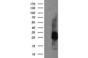 Image no. 6 for anti-Cytidine Monophosphate (UMP-CMP) Kinase 1, Cytosolic (CMPK1) antibody (ABIN1497542)