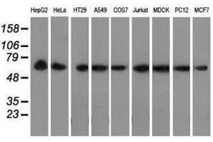 Image no. 2 for anti-Peroxisomal Biogenesis Factor 5 (PEX5) antibody (ABIN1500156)